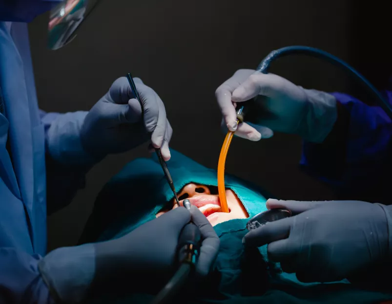 Chirurgie orale